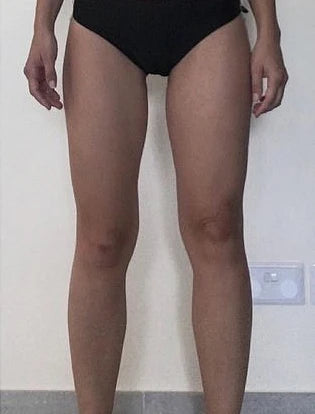 SONRASI